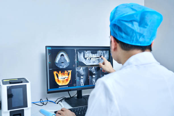 Best Dentist for Tooth Abscess  in Burlington, CO